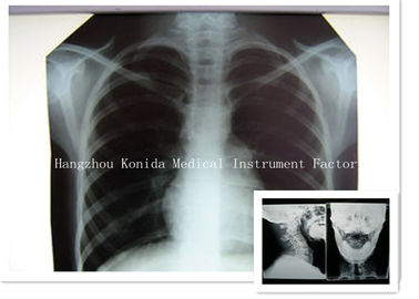 Película radiográfica de X Ray de Digitaces de la película 14 x 17inch de la proyección de imagen seca médica de la salud