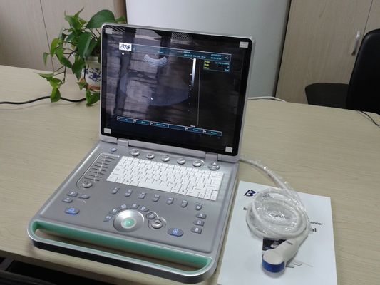 analizador portátil del ultrasonido del ordenador portátil de 3D Digitaces con toda clase de punta de prueba